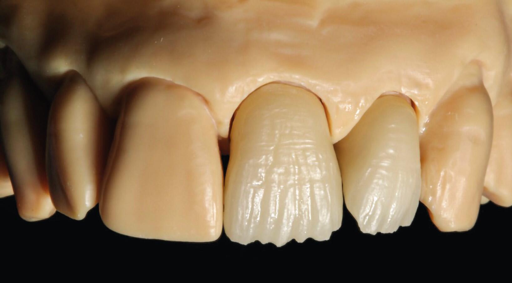 Ana(logisch)-Digital „Verblendet“