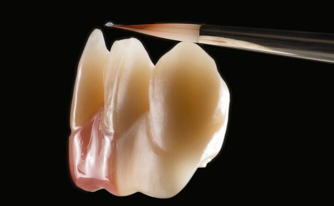 IPS e.max Ceram Art Malkurs auf IPS e.max ZirCAD Prime und Prime Esthetic – Rot / Weiß Ästhetik