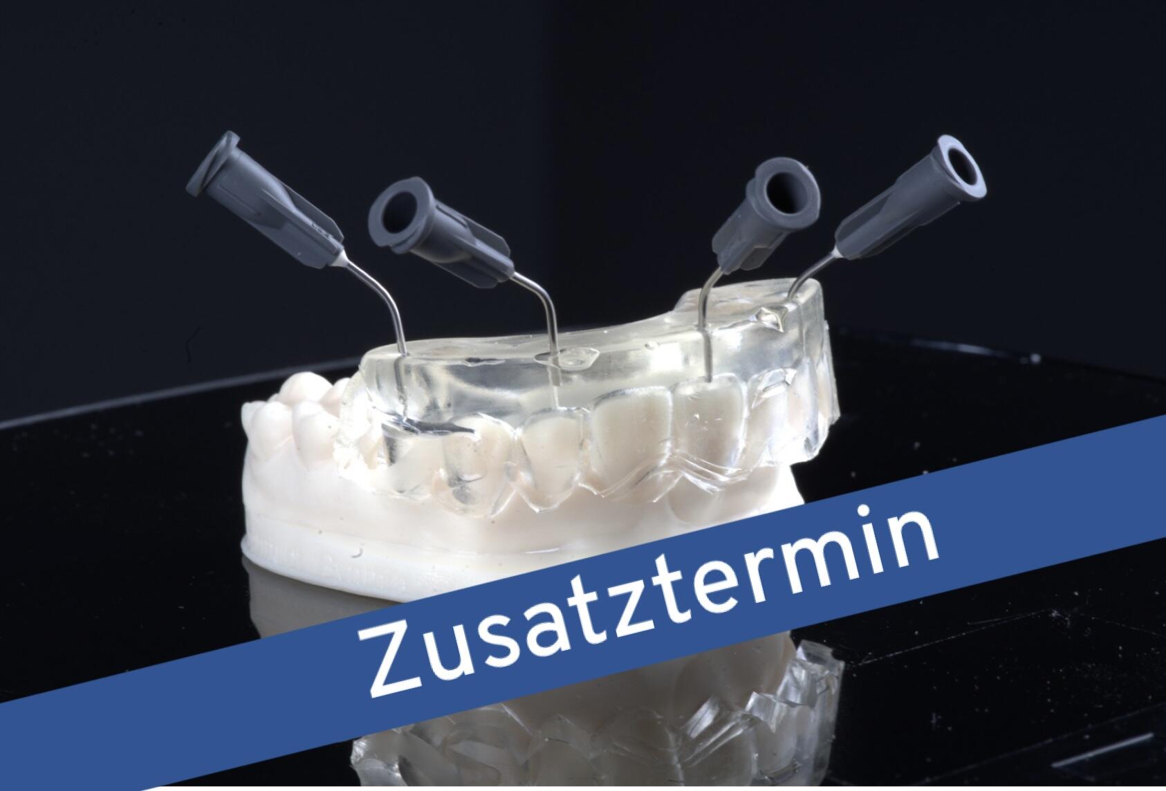 Injizieren statt Schichten – Ästhetische direkte Restaurationen mit der minimalinvasiven Injection Moulding Technik (IMT)