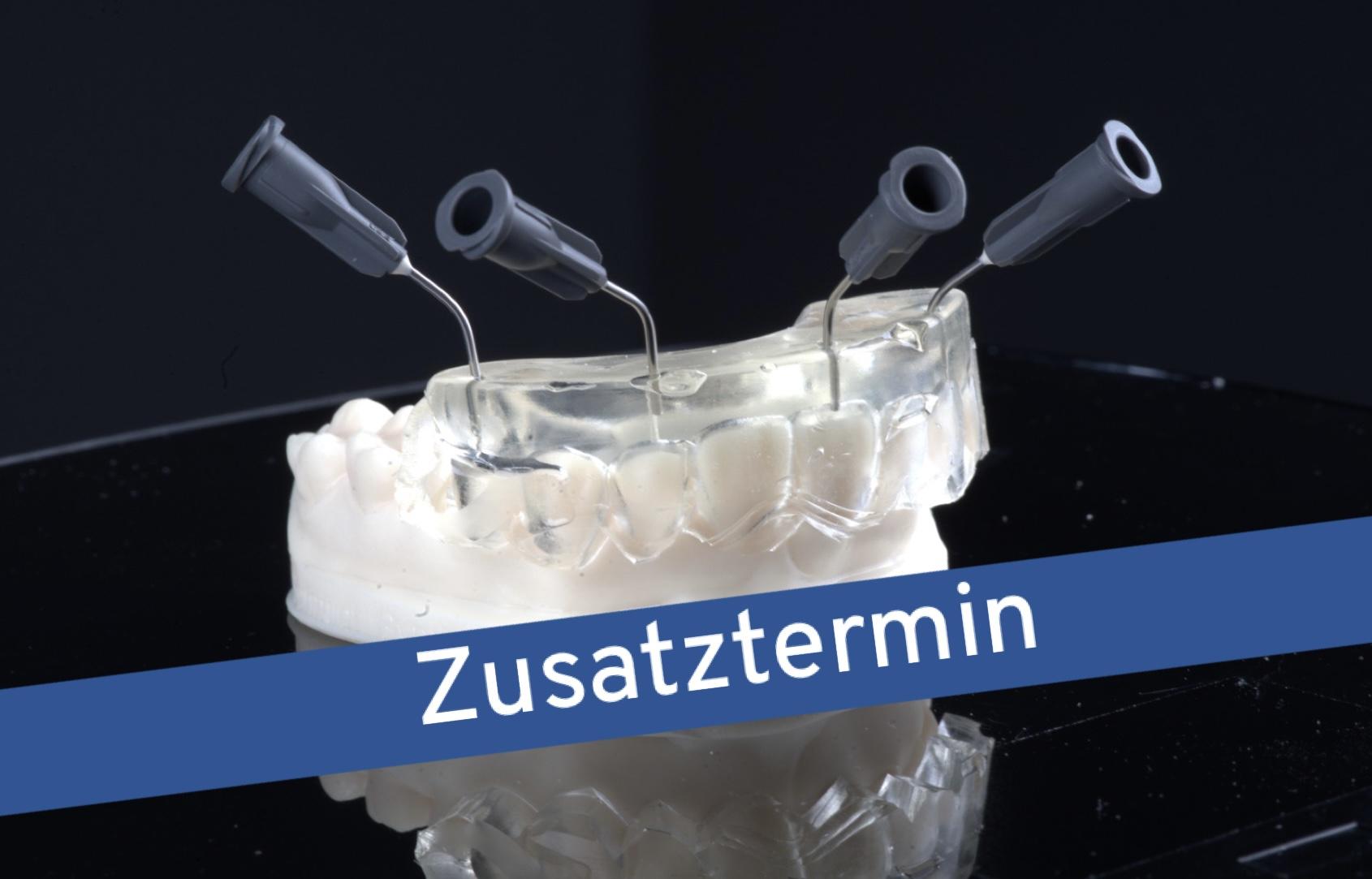 Injizieren statt Schichten – Ästhetische direkte Restaurationen mit der minimalinvasiven Injection Moulding Technik (IMT)